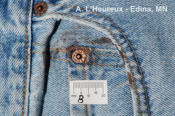 Macro Photography - Bloodstains on Jeans